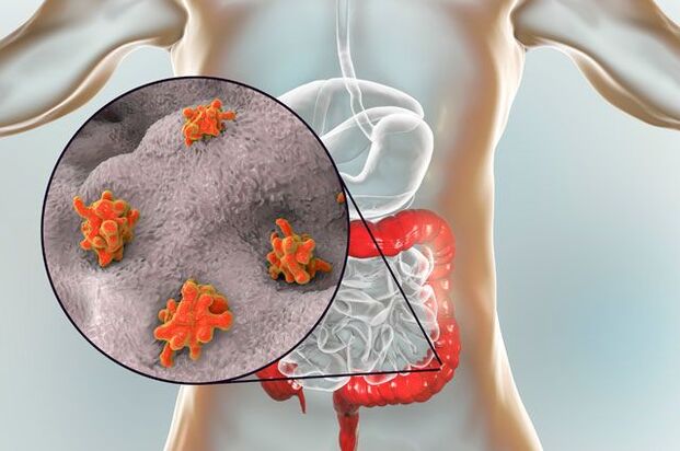 Τύποι παρασίτων στο ανθρώπινο σώμα